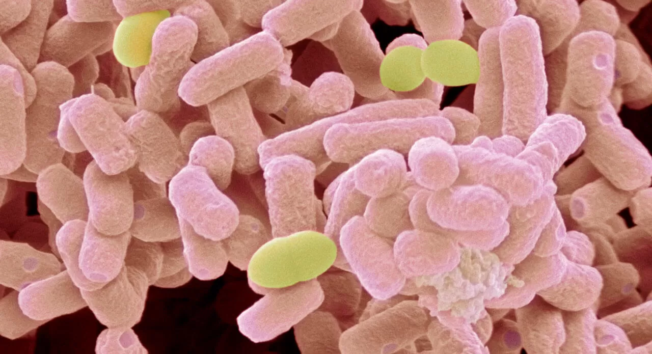 e.coli_gettyimages-99310938-1280x695.jpg